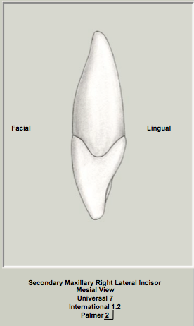 Ext Morph Mx Lateral Mesial 1.png